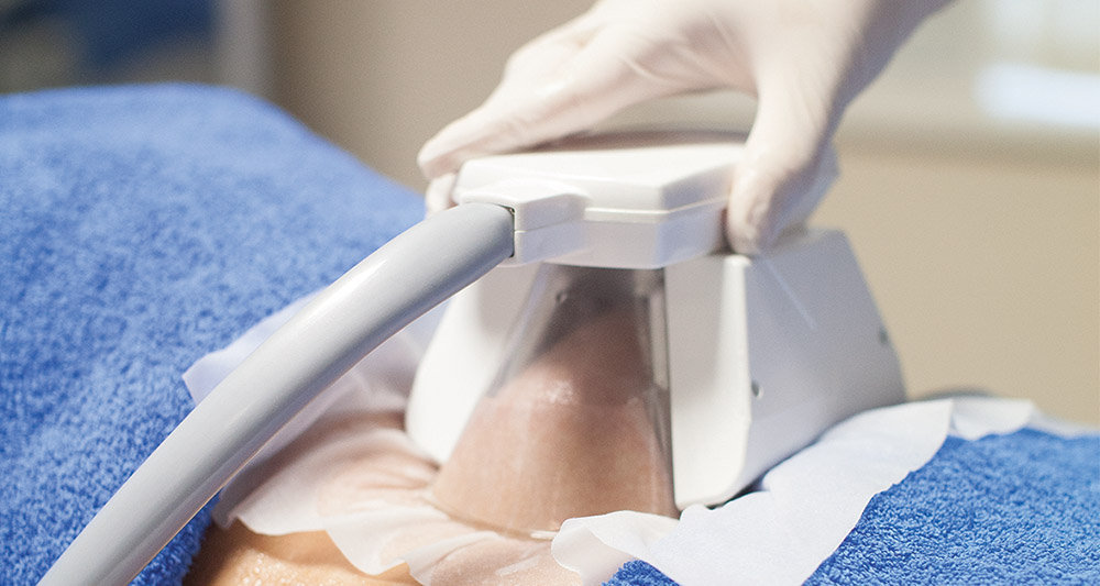 How Fat Freezing and HIFU Work Together? 2 Multiple Areas in One Session HIFU and Fat Freezing Rushden