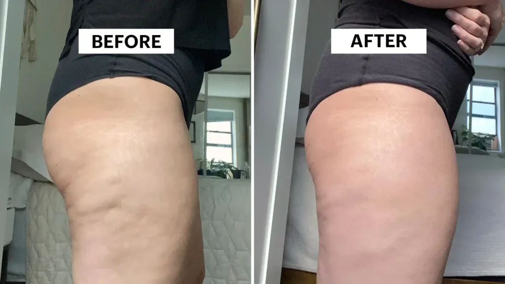 Sculpting Your Bum: Can Toning Exercises Really Reduce Cellulite? 1 Do Toning Exercise Rushden Really Tackle Cellulite?