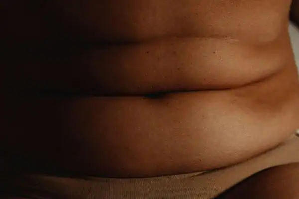 The Hidden Connection: How Stress Shapes Your Fitness and Body Composition 3 image of what stress can do on the stomach area and how Lipo 360 Rushden can help to change your body shape.